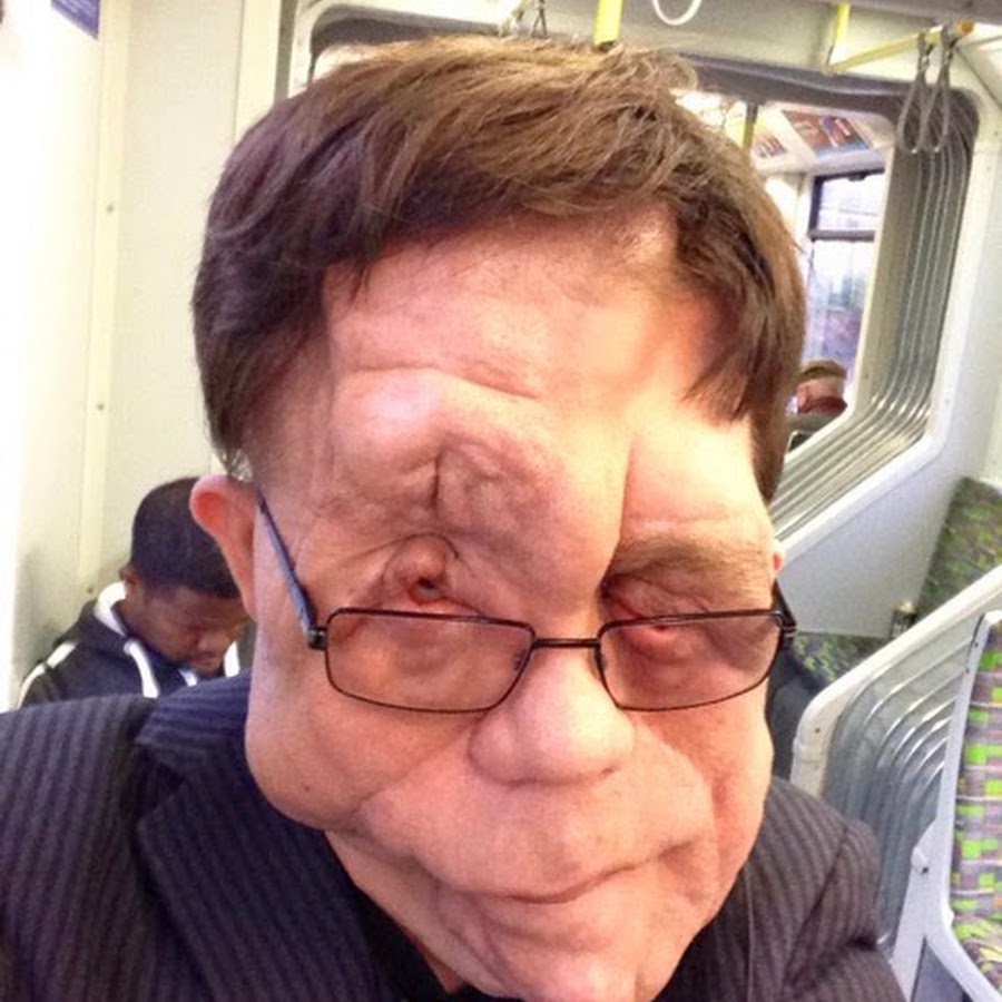 Adam Pearson Youtube