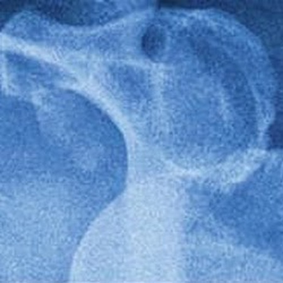 AKedOLREsPAXDUiiyykbA6T5rgCPVUDgNZthrRbQ0mj=s900ckc0x00ffffffnorj