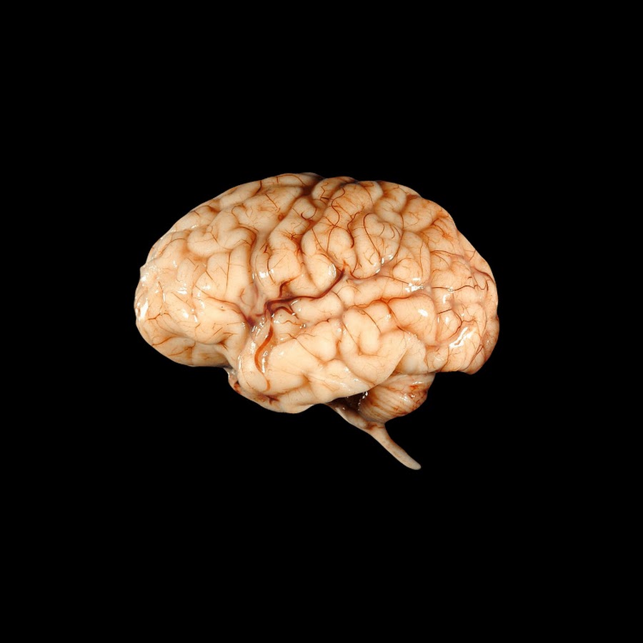 Brain project. Проект мозг. Проект мозг Радевич. Проект мозг человека. Защита мозга.