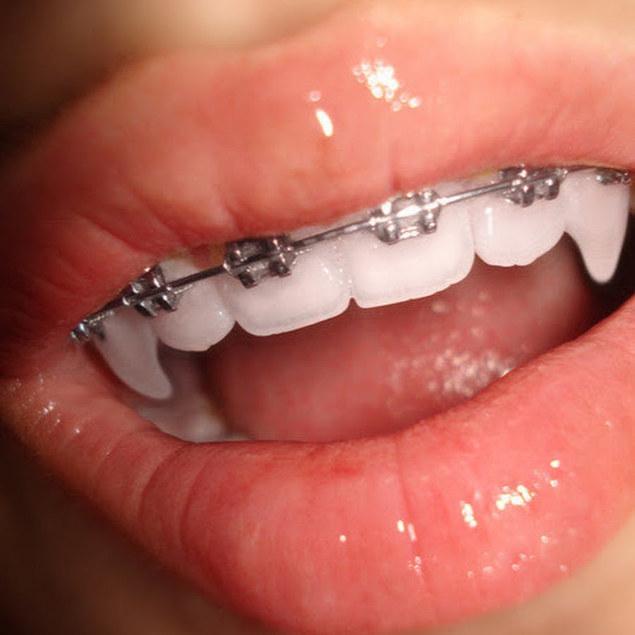 Клыки у человека красивые