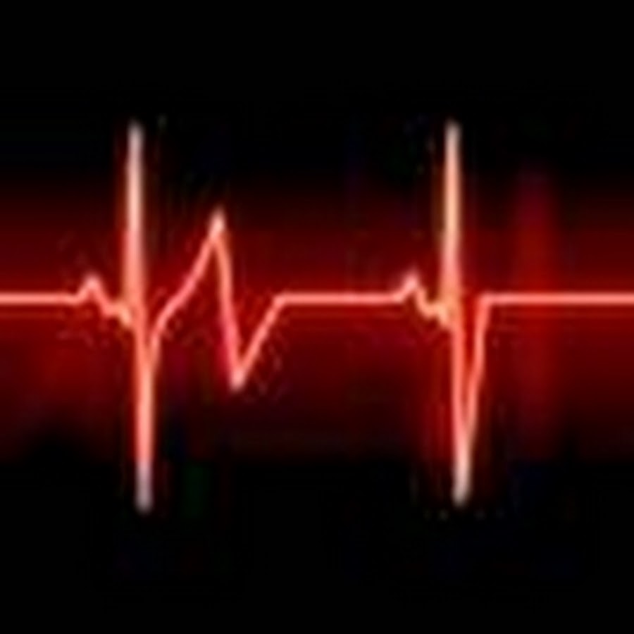 пульс это определение кратко. тахикардия. русский пульс. русский пульс. пульс.