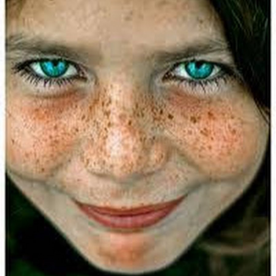 Веснушчатый нос. Пигментная ксеродерма ксеродерма. Портрет с веснушками. Веснушки у детей. Чувствует веснушками.