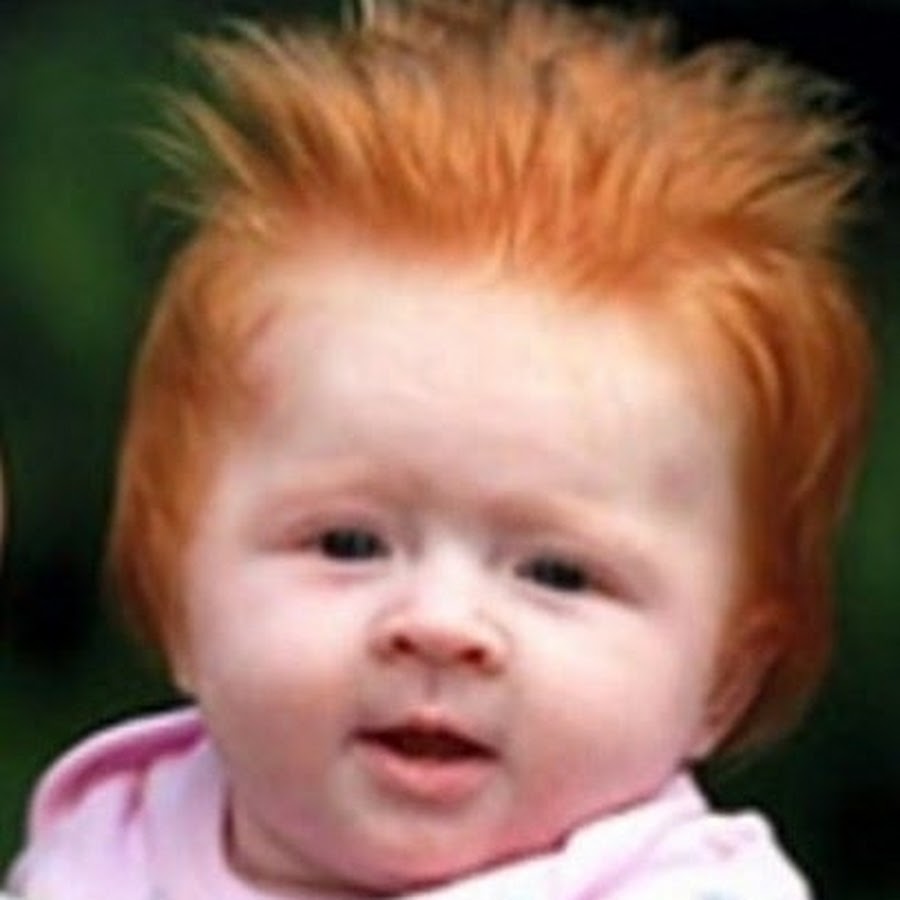 Родилась с рыжими волосами. Младенец с рыжими волосами. Рыжие волосы у новорожденного. Новорожденные с рыжими волосами. Рыжий цвет волос у новорожденного.