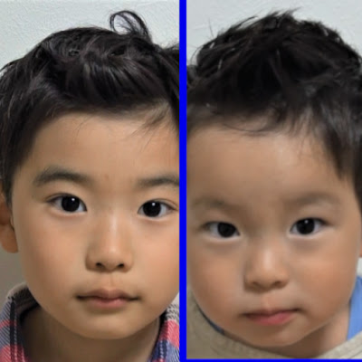 子供のまぶたが一重から二重になるまで Youtube