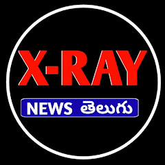 X Ray News Telugu thumbnail