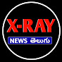 X Ray News Telugu