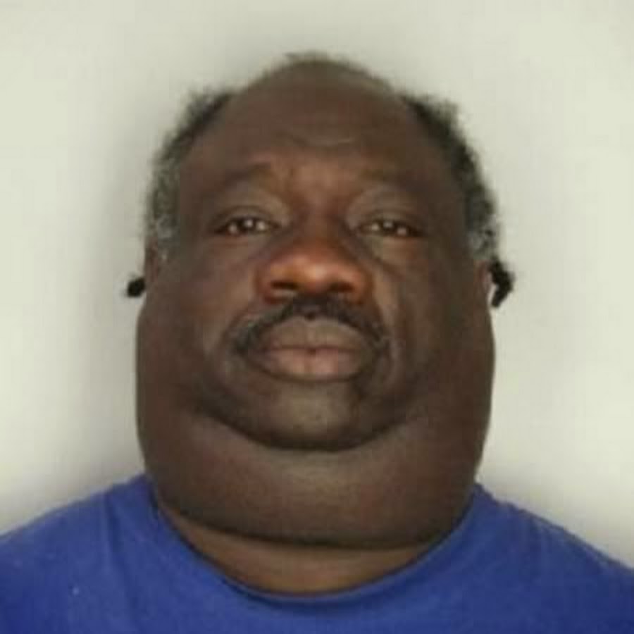Black guy who gotta Fat huge neck! 