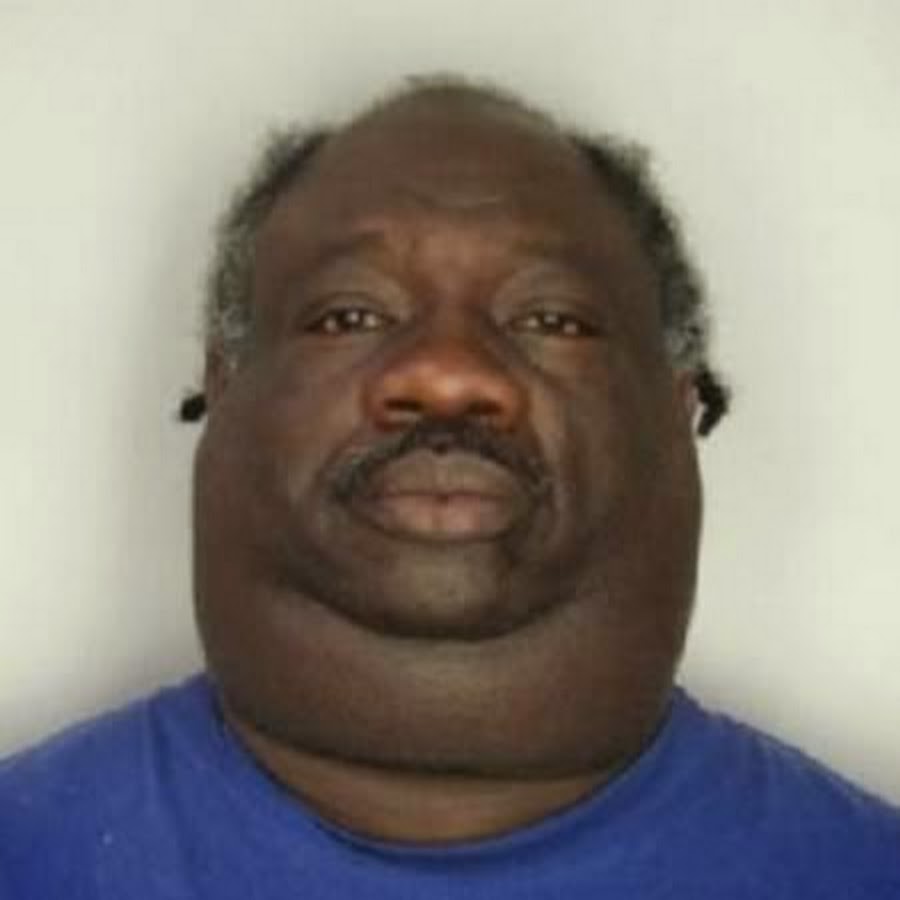 Black Guy Who Gotta Fat Huge Neck Youtube