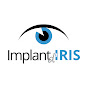 Implant Iris YouTube Profile Photo