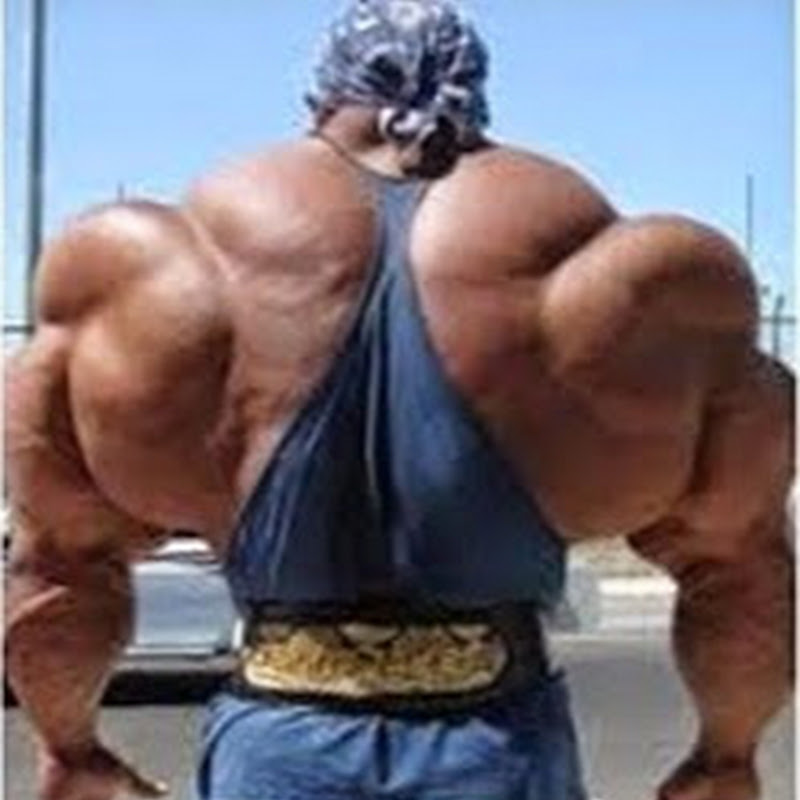 synthol man biggest biceps in the world !! 3ajaib wa gharaib 2017