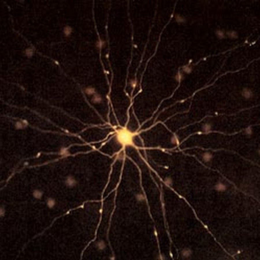 Нервная ткань сетчатки глаза. Нервные клетки сетчатки глаза. Нейроны сетчатки гистология. Глаукома оптическая нейропатия. Нервные клетки сетчатки лошади препарат.