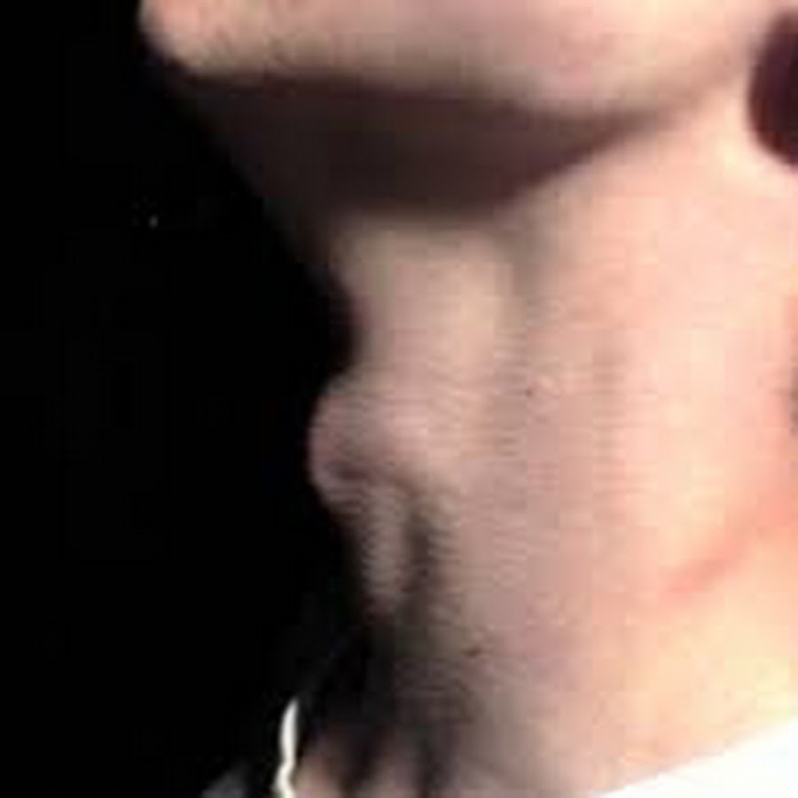 красивая мужская шея. Adams apple men. кадык влада а4. что будет если сломать кадык. болит щитовидный хрящ гортани.