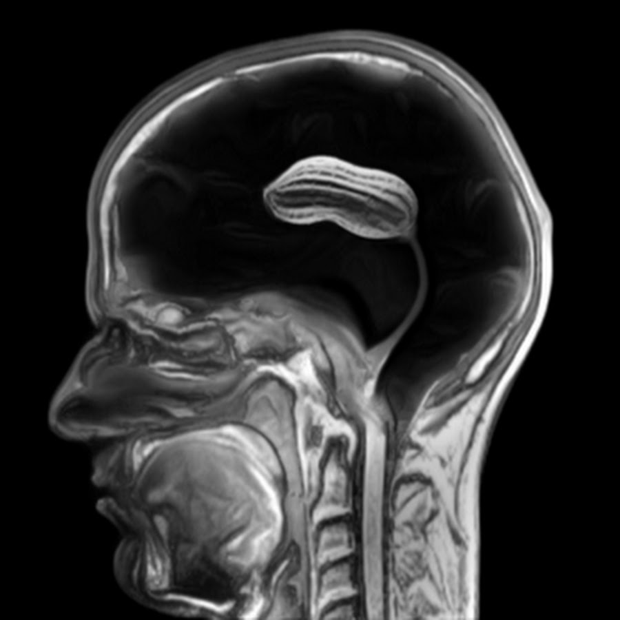 AMLnZu9Yw6kbp5cohN83BIs2NYkUXT9UYErpyijYj7s=s900ckc0x00ffffffnorj