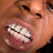 Lil Waynes Teeth