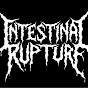 INTESTINALRUPTURE logo